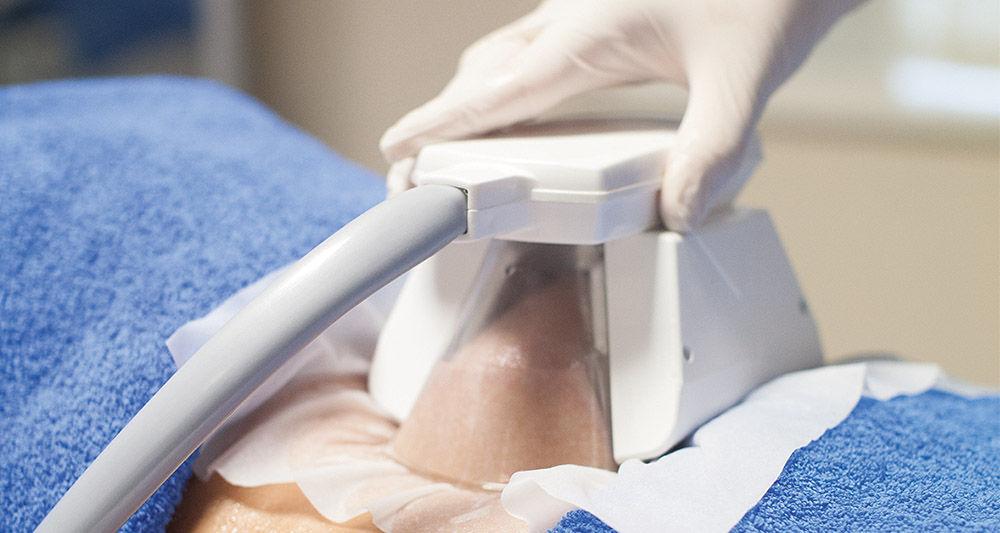 How Fat Freezing and HIFU Work Together? 2 Multiple Areas in One Session HIFU and Fat Freezing Cranleigh