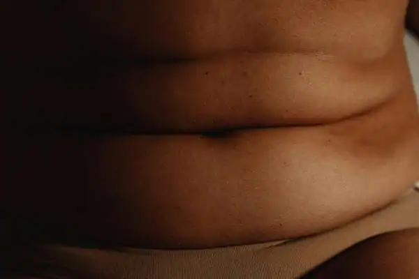 The Hidden Connection: How Stress Shapes Your Fitness and Body Composition 3 image of what stress can do on the stomach area and how Lipo 360 Cranleigh can help to change your body shape.