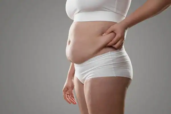 Image of stress belly Cranleigh How Lipo 360 can help manage your symptoms